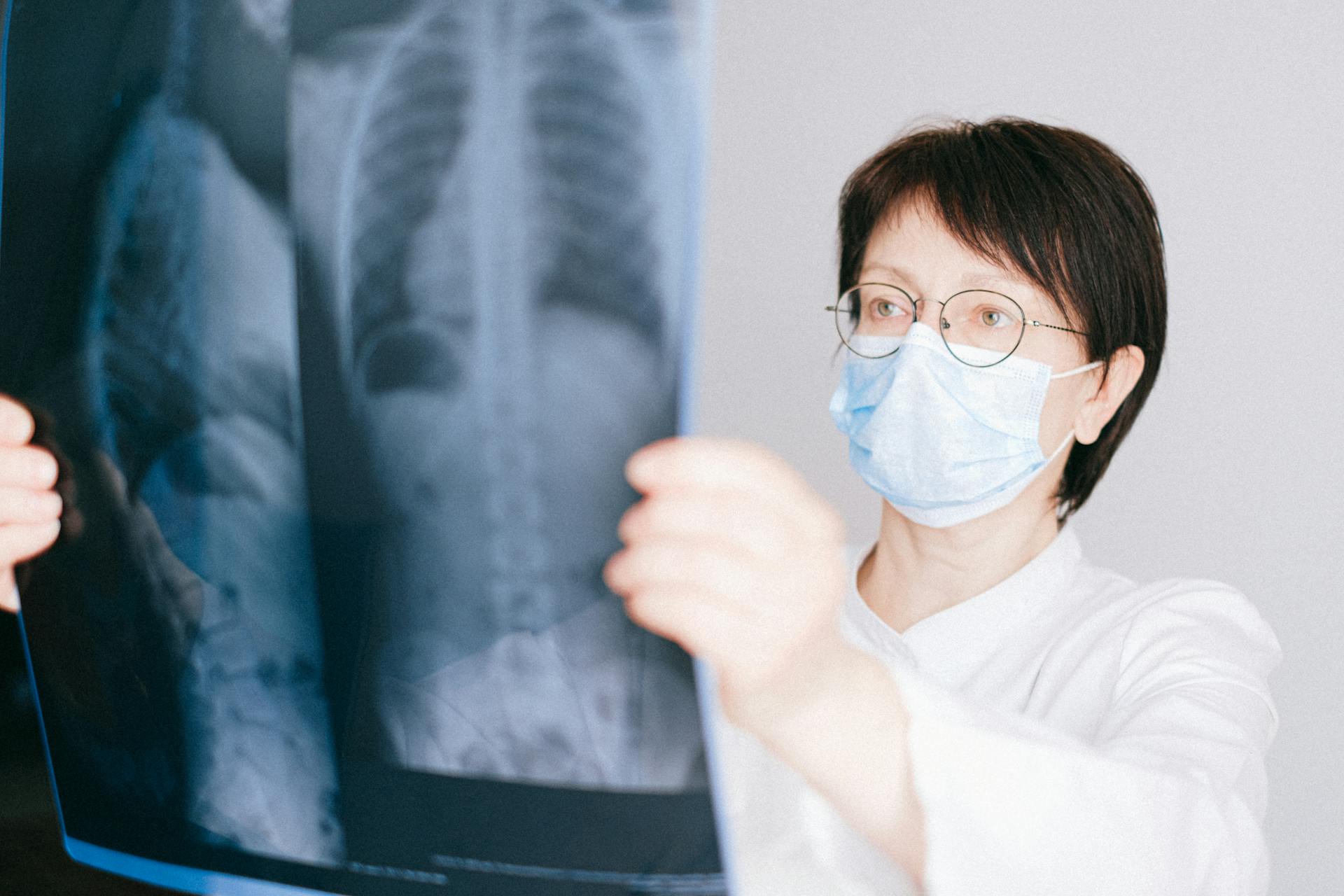 Female doctor examining a chest X-ray