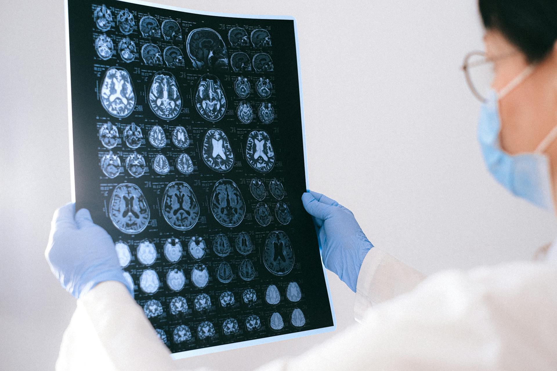 AI-driven personalised radiology will improve diagnoses, says Future Opportunities report