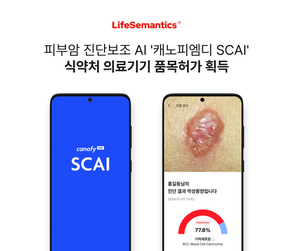LifeSemantics receives approval for skin cancer AI solution